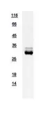Human CSEN protein, His tag. GTX111911-pro
