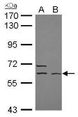 Anti-ELP3 antibody [N3C3] used in Western Blot (WB). GTX111912