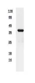 Human CDK7 protein, His tag. GTX111919-pro