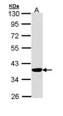 Anti-PIG3 antibody [N1C3] used in Western Blot (WB). GTX111926
