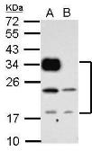 Anti-CD74 antibody used in Western Blot (WB). GTX111929