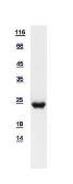 Human RAP1B protein, His tag. GTX111933-pro
