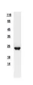 Human RAP1B protein, His tag. GTX111933-pro