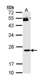 Anti-RAP1B antibody used in Western Blot (WB). GTX111933
