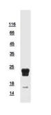 Human RPL17 protein, His tag. GTX111934-pro