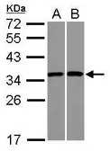 Anti-RPS3A antibody used in Western Blot (WB). GTX111935