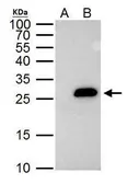 Anti-Securin antibody used in Immunoprecipitation (IP). GTX111938