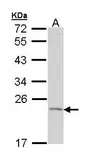 Anti-TNFAIP8 antibody [N1C3-2] used in Western Blot (WB). GTX111940