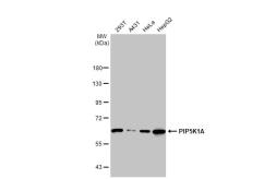 Anti-PIP5K1A antibody [N1N3] used in Western Blot (WB). GTX111953