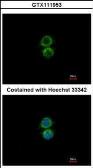 Anti-PIP5K1A antibody [N1N3] used in Immunocytochemistry/ Immunofluorescence (ICC/IF). GTX111953