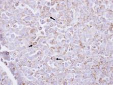 Anti-PIP5K1A antibody [N1N3] used in IHC (Paraffin sections) (IHC-P). GTX111953