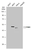 Anti-TRIB1 antibody [N2C3] used in Western Blot (WB). GTX111960