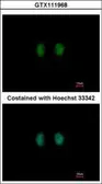 Anti-IPPK antibody [N2C2], Internal used in Immunocytochemistry/ Immunofluorescence (ICC/IF). GTX111968