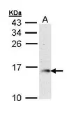 Anti-GMF beta antibody [N1C3] used in Western Blot (WB). GTX111991