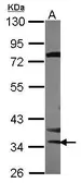 Anti-STK16 antibody [N1C3-3] used in Western Blot (WB). GTX111994