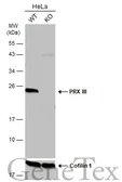 Anti-PRX III antibody [N1C3] used in Western Blot (WB). GTX112004