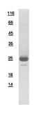 Human AGPHD1 protein, His tag. GTX112009-pro