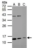 Anti-ROPN1B antibody used in Western Blot (WB). GTX112010