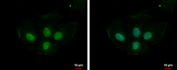 Anti-PRPS1L1 antibody used in Immunocytochemistry/ Immunofluorescence (ICC/IF). GTX112011