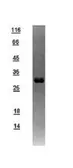 Human UQCR protein, GST tag. GTX112016-pro