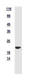Human SKP1 protein, His tag. GTX112041-pro