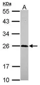Anti-NGF beta antibody [N1C3-2] used in Western Blot (WB). GTX112043