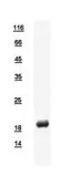 Human DUSP21 protein, His tag. GTX112045-pro