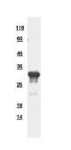 Human Casein Kinase 1 Alpha 1L protein, His tag. GTX112052-pro
