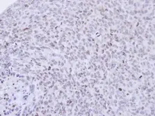Anti-PCNP antibody [N1N2], N-term used in IHC (Paraffin sections) (IHC-P). GTX112059