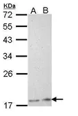 Anti-Phospholipase A2 XIIA antibody [N1C1] used in Western Blot (WB). GTX112060