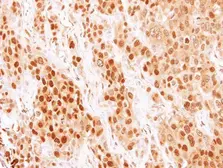 Anti-COMMD7 antibody used in IHC (Paraffin sections) (IHC-P). GTX112076