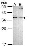 Anti-NOSIP antibody [N2C1], Internal used in Western Blot (WB). GTX112082