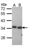 Anti-PECR antibody [C2C3], C-term used in Western Blot (WB). GTX112083