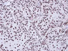 Anti-Apoptosis-enhancing nuclease antibody [C2C3], C-term used in IHC (Paraffin sections) (IHC-P). GTX112086