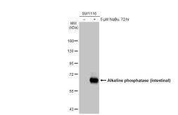Anti-Alkaline phosphatase (intestinal) antibody used in Western Blot (WB). GTX112100