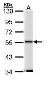 Anti-Septin 11 antibody [N1C1] used in Western Blot (WB). GTX112103