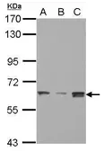 Anti-SMARCD3 antibody [N2C3] used in Western Blot (WB). GTX112107