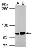 Anti-SFPQ antibody used in Western Blot (WB). GTX112116