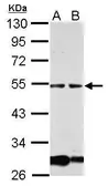 Anti-GCM1 antibody used in Western Blot (WB). GTX112119