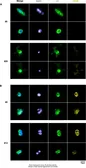 Anti-pan Cytokeratin antibody [C-11] (FITC) used in Immunocytochemistry/ Immunofluorescence (ICC/IF). GTX11212
