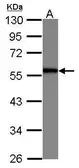 Anti-SERBP1 antibody [N1C2] used in Western Blot (WB). GTX112129