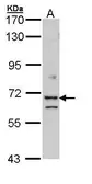 Anti-EXOC7 antibody [N1C1] used in Western Blot (WB). GTX112132