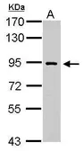 Anti-DNA polymerase iota antibody used in Western Blot (WB). GTX112137