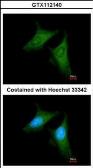 Anti-COPB antibody [N1N3] used in Immunocytochemistry/ Immunofluorescence (ICC/IF). GTX112140