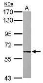 Anti-Alkaline phosphatase (intestinal) antibody used in Western Blot (WB). GTX112142