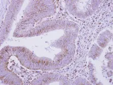 Anti-COPB antibody used in IHC (Paraffin sections) (IHC-P). GTX112164