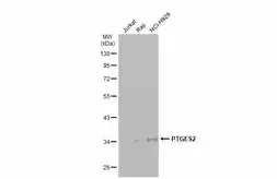 Anti-PTGES2 antibody [N2C3] used in Western Blot (WB). GTX112174
