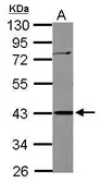 Anti-APOBEC3G antibody [N1C1] used in Western Blot (WB). GTX112176