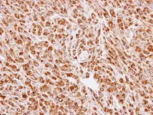 Anti-Calreticulin 3 antibody used in IHC (Paraffin sections) (IHC-P). GTX112177