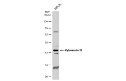 Anti-Cytokeratin 23 antibody used in Western Blot (WB). GTX112183